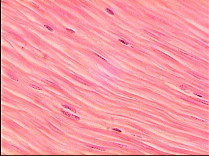 Muscle Tissue Smooth muscle Surrounds