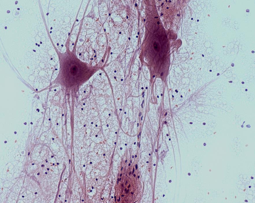 A. Nervous tissue - neurons Figure 33.