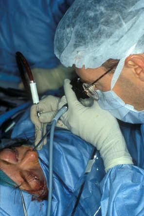 Endoscopic Assisted