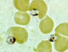 Three Leishmania amastigotes, each with a clearly visible nucleus and kinetoplast, from the same impression