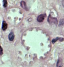 Leishmania mexicana in a biopsy specimen from a skin lesion stained with hematoxylin and eosin.