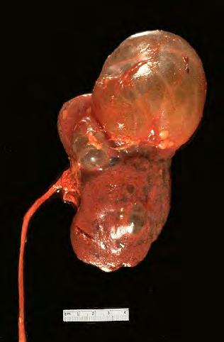 As mice age, the kidneys develop similar cysts due