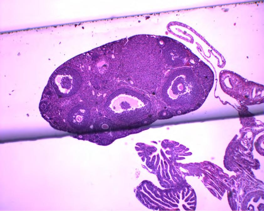 Mouse ovary, fallopian tube, uterus Many