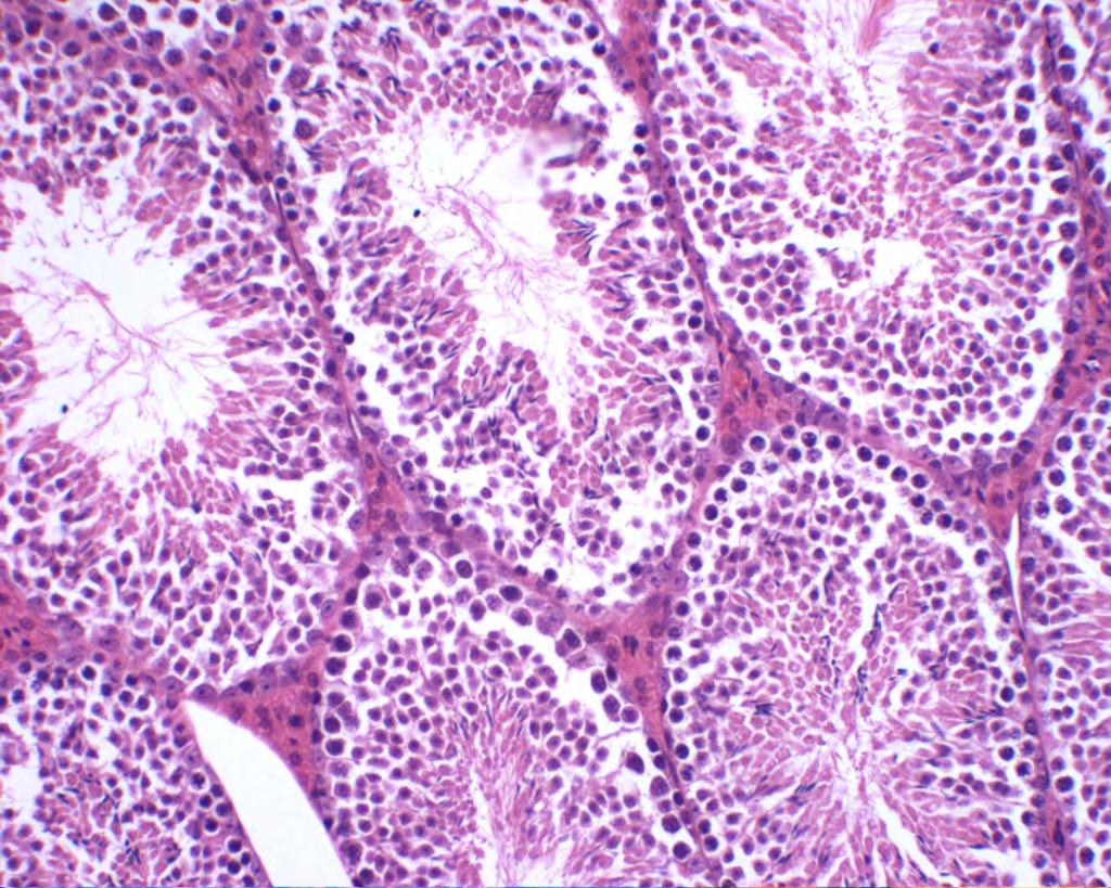 H&E of a section of mouse testis (not fixed well)!