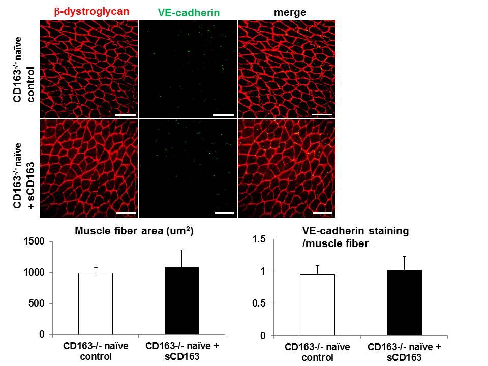 Figure 15. scd163 has no effect on vascularity and muscle morphology in CD163-/- mice without ischemic injury.