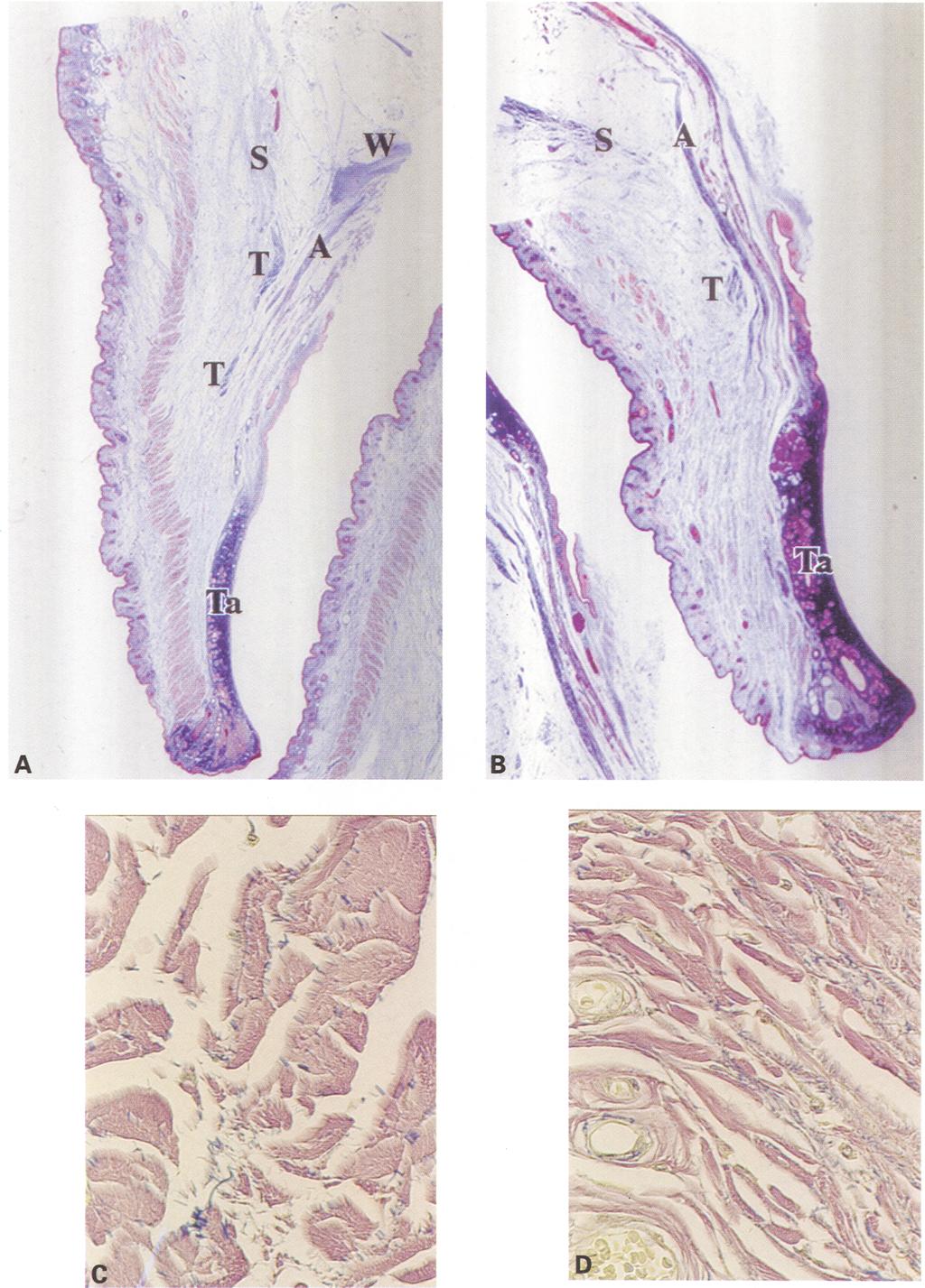 (S: orbital septum, A: levator aponeurosis, W: Whitnall's ligament, Ta: tarsus, T: lower-positioned transverse ligamentous tissue.