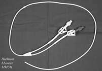 Appendix 5: Types of intravascular catheters (continued) Description Catheter type Common use Characteristics Common site of access Tunnelled CVC Long-term CVCs, the proximal end of which exits via a