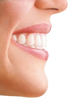 Whether your teeth are crowded, crooked, gapped, buck or have shifted since wearing braces, you'll have reason to smile.