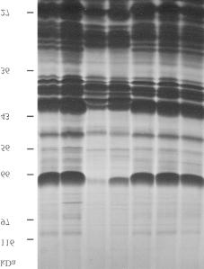 80 ma for 3 h. Proteins were stained with 0.02% Coomassie Brilliant Blue R 250 in 40% methanol, 10% glacial acetic acid.