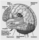 Your Job Disorder s Job The amygdala I want this Frequency Intensity Duration Terrified of it! Give it to me!