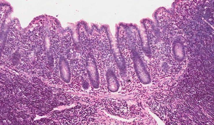 Appendix 1- Mucosa: Epithelium