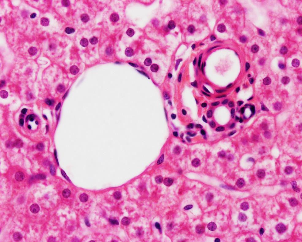 T Mention four cells in the square: d) Hepatocytes.
