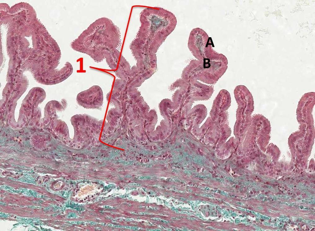 Gallbladder 1- Mucosa: Epithelium lining (Similar to the Colon) : simple columnar