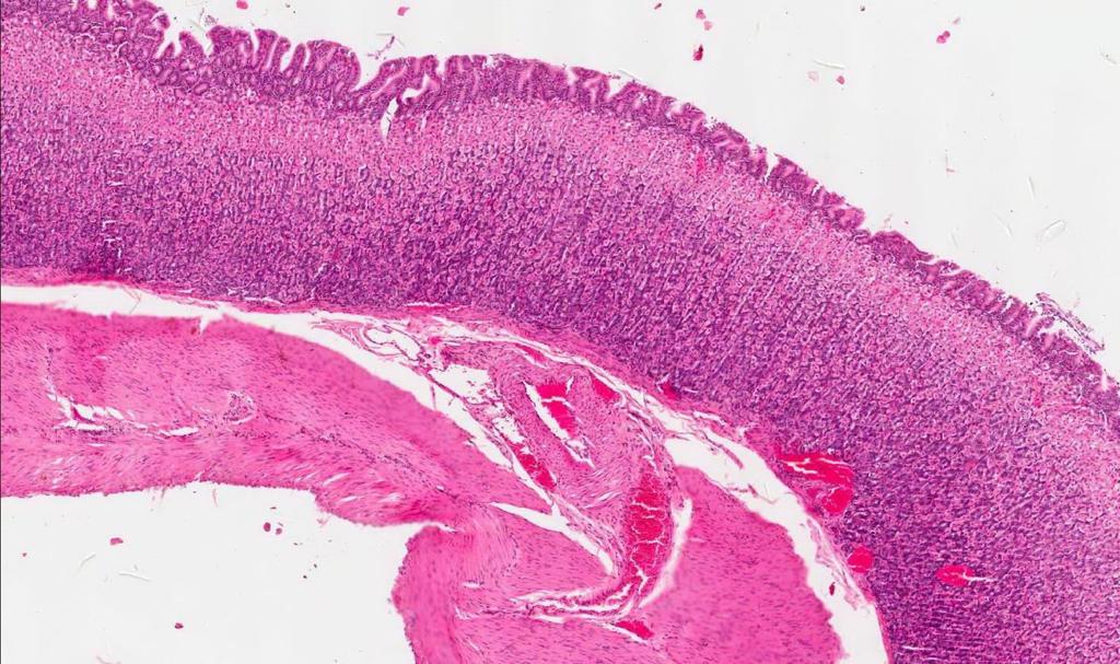 1- Mucosa: Fundus of the stomach Fundic Glands Epithelium: simple columnar epithelium Lamina propria Muscluaris