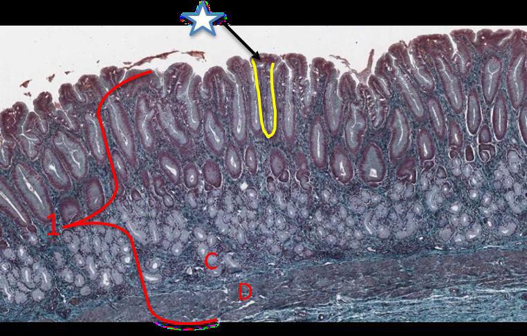 1- Mucosa: Pylorus of the stomach Epithelium: simple columnar epithelium Pyloric Glands : Mucous