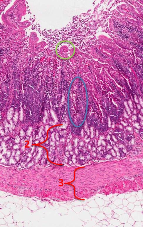 Duodenum 1- Mucosa (Shows villi and crypts) :