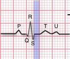 T wave First upward deflection after S wave Represents repolarization of the ventricles QT interval Beginning of Q wave to end of T wave Represents time it takes for impulse to travel from AV node