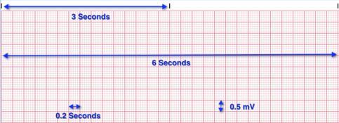 Putting impulses on paper Guiding Principles of the ECG A standard ECG is printed at 25mm per second or 25 small squares per second, making it is possible to calculate the duration of individual