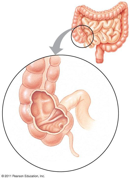 Absorption in the Large Intestine The colon of the large intestine is connected to the small intestine The cecum aids in the fermentation of plant material and connects where the small and