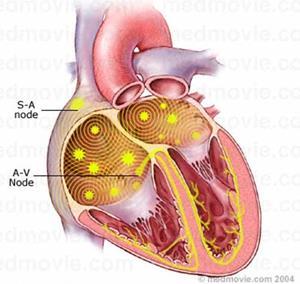 Atrial Dysrhythmias Most atrial dysrhythmias are not lethal but some may require