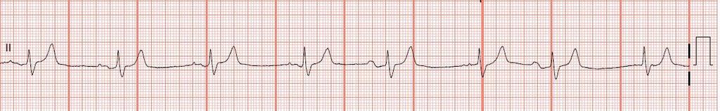 Rhythm Interpretation MEASURE: PR interval Rhythm QRS complex Heart rate