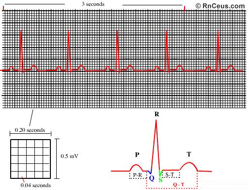 How to Read a Rhythm Strip The conduction of an electrical impulse for a single heart beat normally contains five major