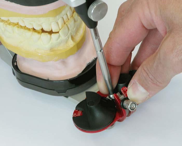 A 7.8 Programming the adjustable incisal plate A 7.8. By use of a situation model Before cutting the teeth, a situation model from the patient is produced.
