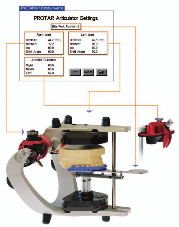 A 9 Programming the articulator with data from ARCUSdigma (Mat. No..000.