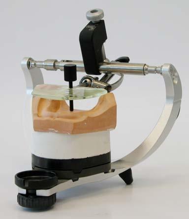 aspects have governed mounting of the model in the articulator (face bow or jig for averagevalue articulator).