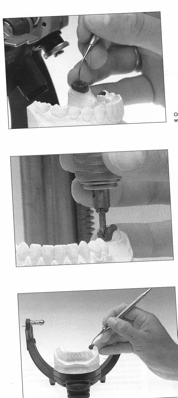 Occlusal features can be constructed in the articulator. The necessary milling work can be carried out at any time.