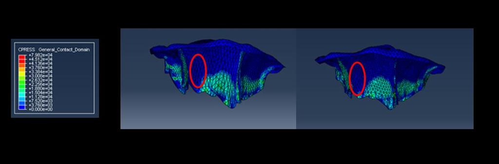 59 Figure 27: Comparison of Von Mises stress between (a) IA-FeMesh generated mesh and (b) ANSYS generated mesh at peak systole (t = 0.2 sec) across P1, P2 and P3.