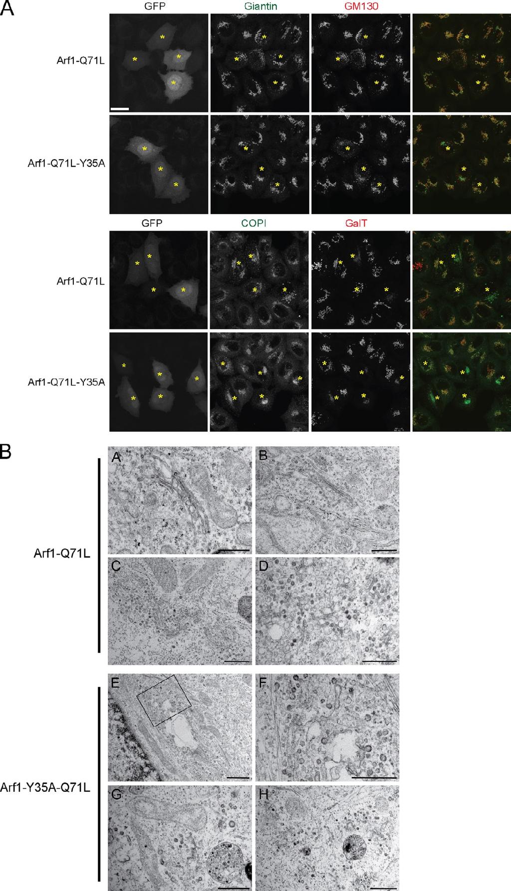 Figure S5. In vivo analysis of dominant-negative Arf1-Q71L or Arf1-Y35A-Q71L in HeLa cells by single-cell thin-section EM and immunofluorescence microscopy.