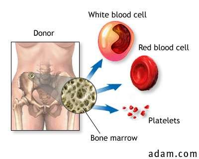 Hematopoietic stem cell sources Bone marrow Autologous Allogenic Peripheral blood