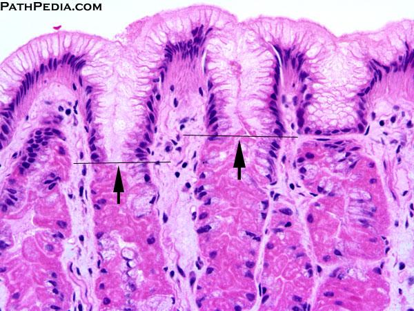 Gastric pits and Glands Gastric pits Apical surface to lamina propria Mucous