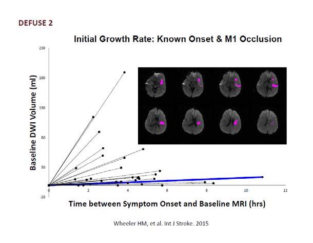 ENDOVASCULAR THERAPY FOLLOWING IMAGING EVALUATION FOR ISCHEMIC STROKE 3 (DEFUSE 3) Prospective randomized Phase III multicenter controlled trial for patients with acute ischemic anterior