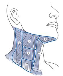Management of Head and Neck Cancer Lymph nodes Surgery Drainage of oral cavity into extensive number of lymph nodes in the neck Neck is divided