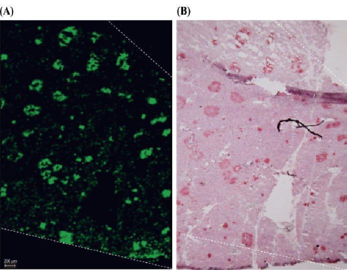 Imaging of regions immunoreactive with anti-synaptophysin Ab in healthy human pancreas. (A) Localization of synaptophysin positive cells by TAMSIM.
