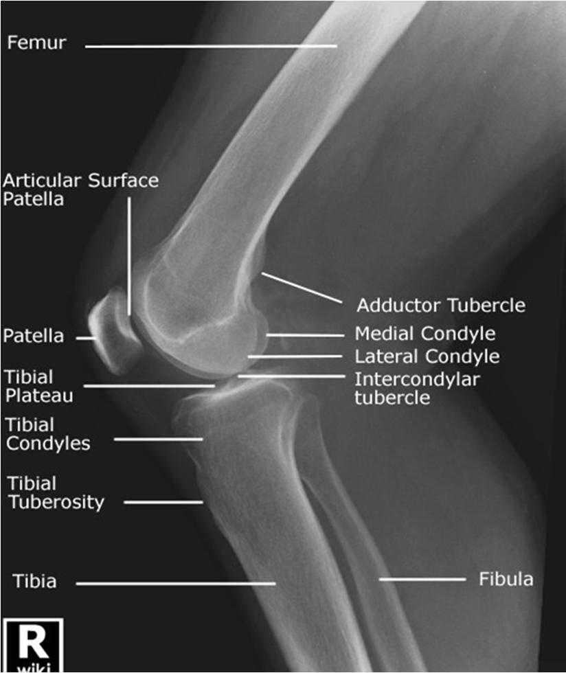 Knee Pain- Radiographs AP weight bearing,