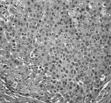 2.1.5.1 Ćelijske komponente 1. Majčinske ćelije Ovo su progenitorne ćelije, nađene u srednjim i velikim kanalima pljuvačnih žlezda [45].