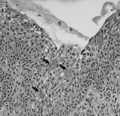 6) prikazane su krupne mukusne ćelije peharastog oblika sa obilnom citoplazmom (A), kao i mukusne ćelije oblika okruglog pečata, izmešane sa intermedijarnim ćelijama (B).