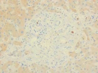 an primary tumor (c) staine for Ki67 by IHC. () Quantification of Ki67 staining.