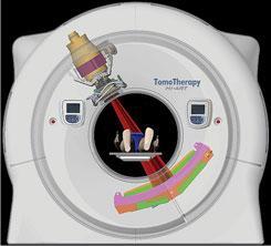 Tomotherapy Combination of two technology systems: Spiral CT scanner and Intensity Modulated Radiotherapy Treatment delivered slice by slice therefore the entire volume can be treated at once (rather