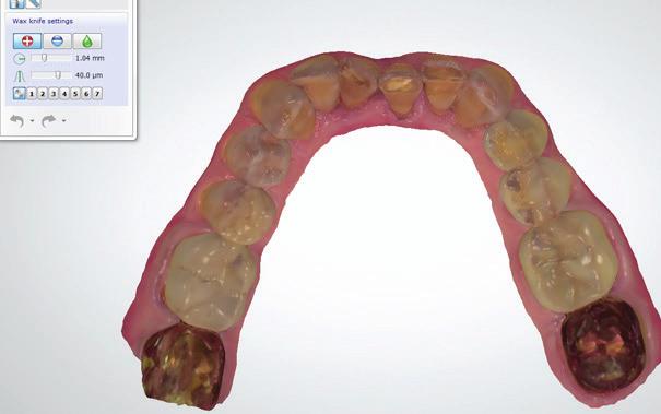 the final restorative state, create a digital diagnostic wax-up, and demonstrate treatment options to the patient (Fig.