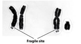arms - Alleles in this region inherited in similar manner to autosomal alleles o Region is called the pseudo-autosomal region - Pseudo-autosomal alleges mediate pairing of X and Y chromosomes during