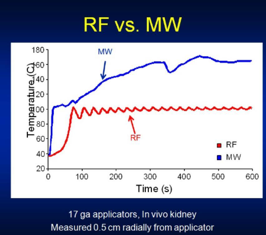 Microwave ablation RFA vs Microwave