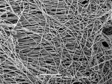 Fig. 3. Resin tags observed with etch-and-rinse adhesives. 3A: PBNT dentin bonding interface (original magnification: SEM 500); 3B: SB dentin bonding interface.