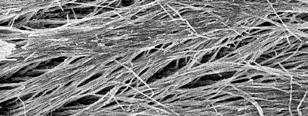 Numerous small lateral extensions of microtags branching off at angles from the main resin tags are visible (original magnification: SEM 3000).