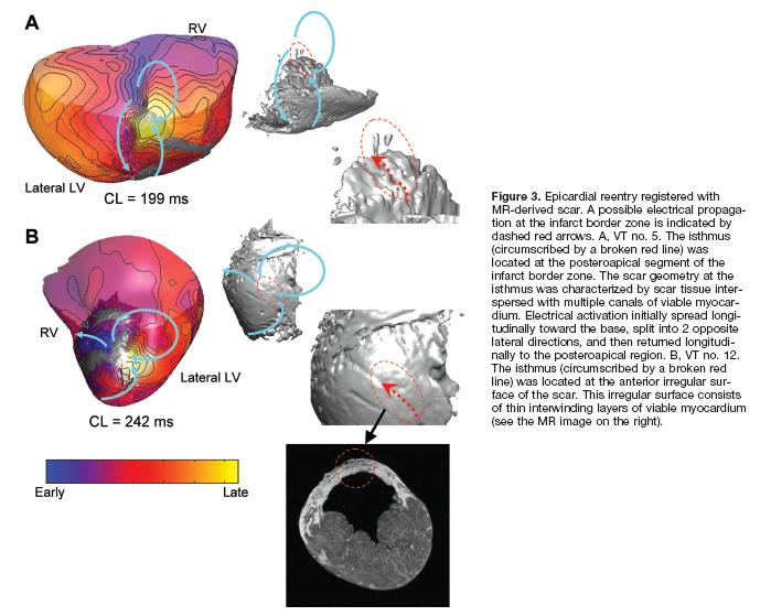 Magnetic Resonance Based Anatomical Analysis of Scar-Related
