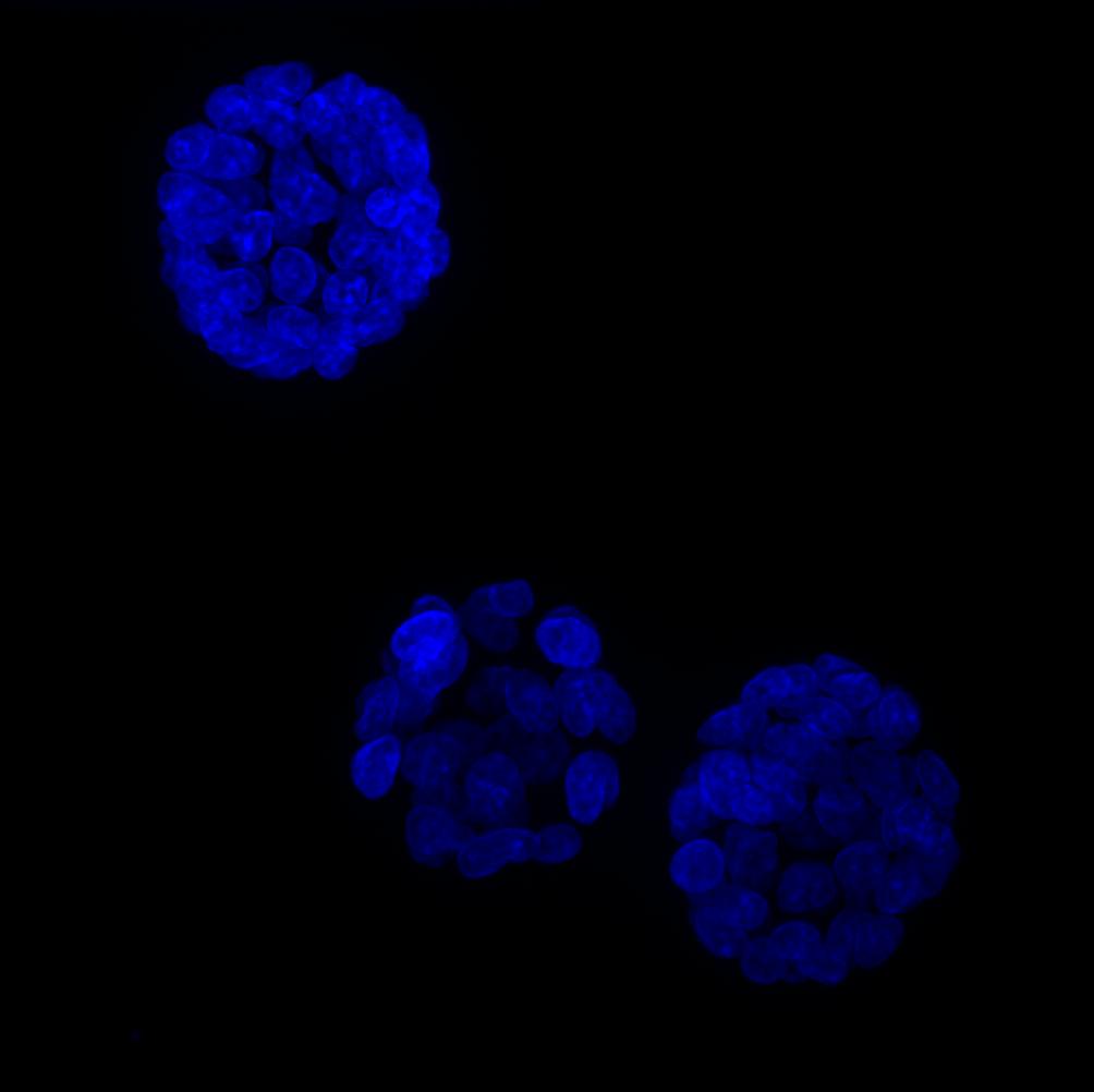 K-RasV12 cells grown in 3-D form mini-cysts by