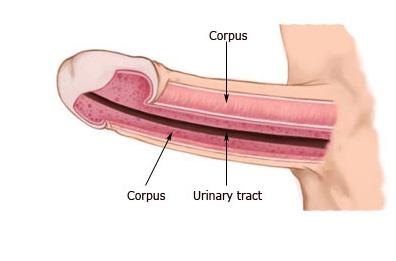 The scar tissue can also cause small indentations in the penis. The curvature can gradually worsen but eventually stabilizes.